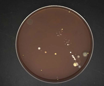 Source colour capture of a round culture dish under a white shadowless ring light: pale spots of different sizes on the dark medium. Complete capture inside the brochure frame, not retouched.